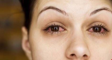 Nếu mắt thường xuyên bị đỏ, bạn nên tới gặp bác sĩ